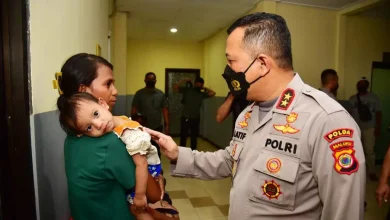 operasi bibir sumbing gratis